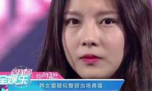 任娜英(正常鼻子吸到断气都不可能达到的效果，快来看看任娜英的整容鼻子)