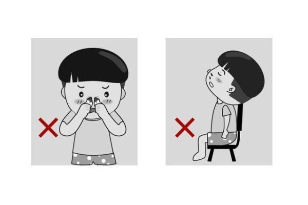 家长必看！正确止鼻血的4个步骤 千万不要再头后仰、塞纸巾