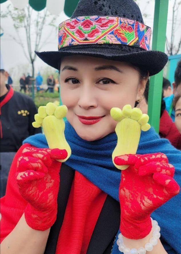 乡爱王云称整容失败，晒近况眼皮红肿超显眼，哭笑不得疑疼痛难忍