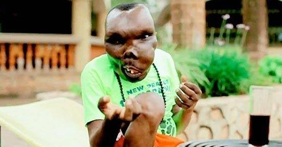 世界上面容最丑的男人！却成为了人生最好的赢家！