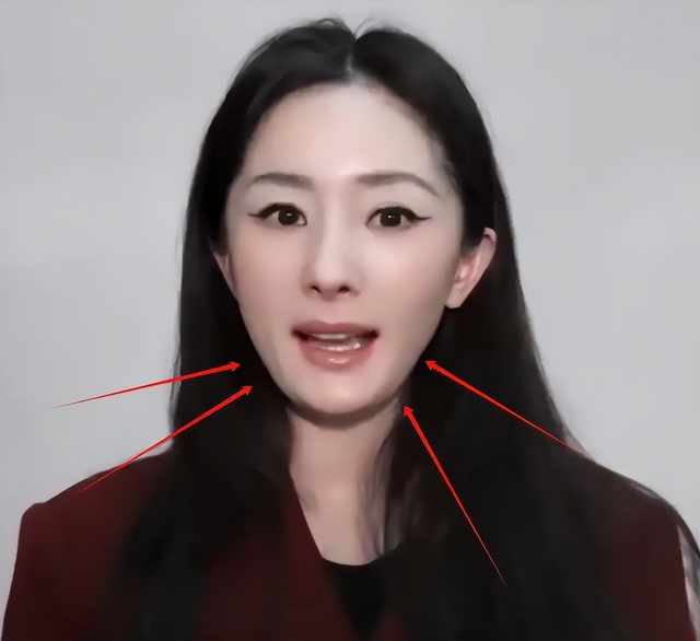 明明是整容脸,却成了颜值巅峰,这5位女星,动脸太成功了