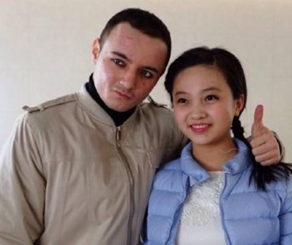 著名童星阿尔法18岁“秃顶”颜值堪忧，如今植发成功帅出新高度