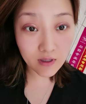 王云图片(乡爱王云称整容失败，晒近况眼皮红肿超显眼，哭笑不得疑疼痛难忍)