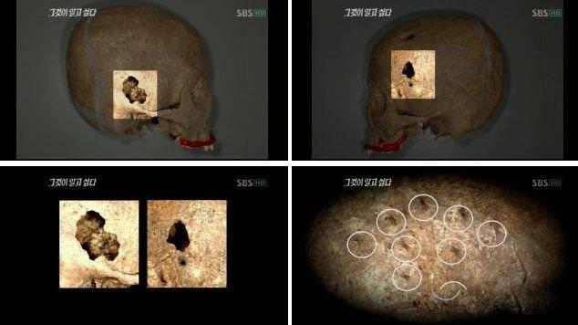 1991年韩国5名少年失踪，11年后发现尸体被叠罗汉，上压一块巨石