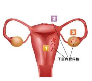 姑娘今年二十八(下个月就要结婚，28岁姑娘却将失去子宫……身体出现这些情况，要警惕)