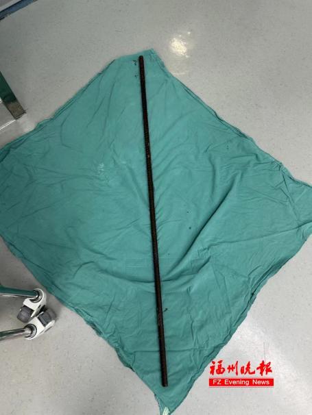 心疼！福建6岁男孩，身体被钢筋贯穿！医生这样救回来……
