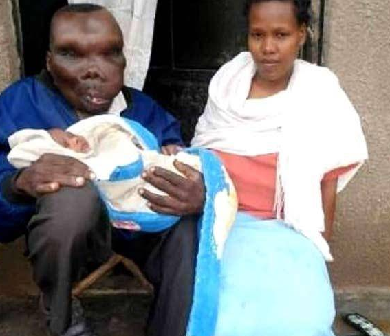 世界上面容最丑的男人！却成为了人生最好的赢家！