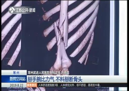 掰手腕需谨慎！大学生和朋友比力气，“吧嗒”的一声，粉碎性骨折