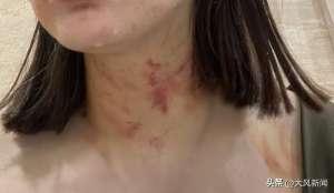 胸裸(电梯内狗尾巴扫到对方腿，23岁女子遭一对夫妇推搡扯衣胸部裸露？涉事业主夫妇否认，自贡警方已展开