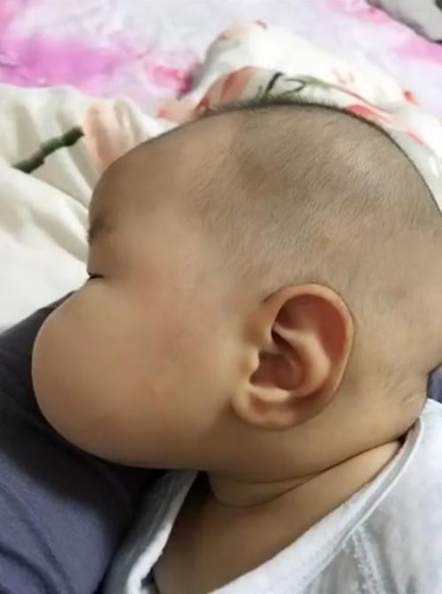 蜡笔小新的“屁桃脸”真的存在吗？妈妈晒宝宝照片，网友：见识了