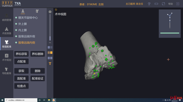 西南地区首例！国产机器人精准辅助全膝关节置换手术 可丝毫不差