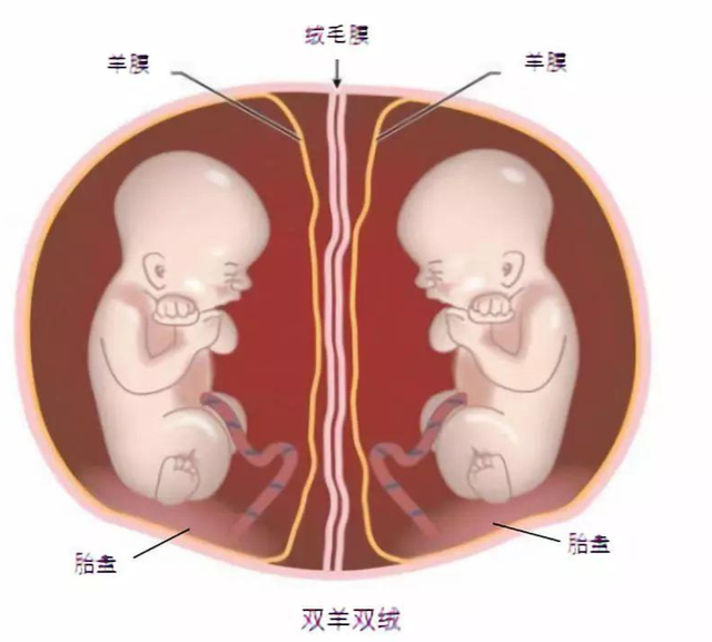 怀上双胞胎全家欣喜若狂，生产时看到两个男孩，医生摇头：活不长