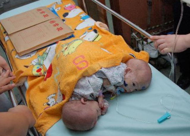 怀上双胞胎全家欣喜若狂，生产时看到两个男孩，医生摇头：活不长