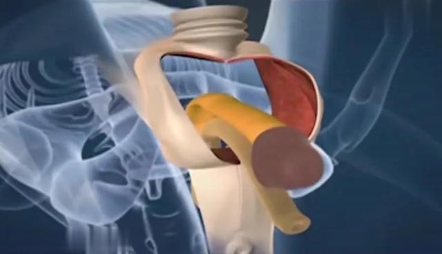 揭秘变性手术全过程：一个男人想变成女人，到底有多难？