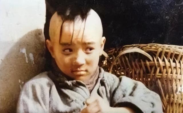 “三毛”孟智超的坎坷星途：14岁秃顶，植发 300 针，复出后被锐评