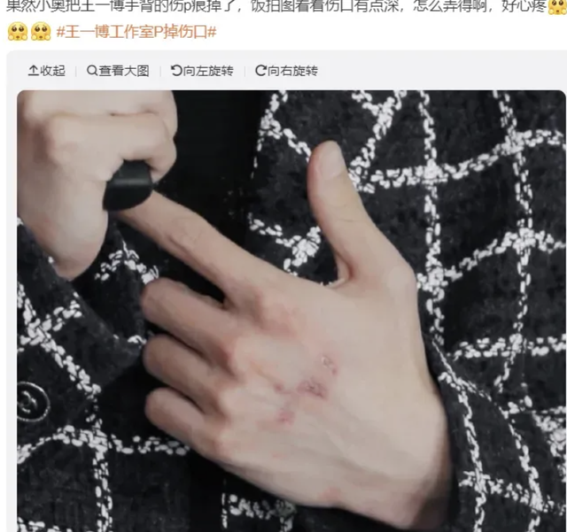 打脸黑子！王一博出发法网公开赛，身上没有疮，生病谣言不攻自破