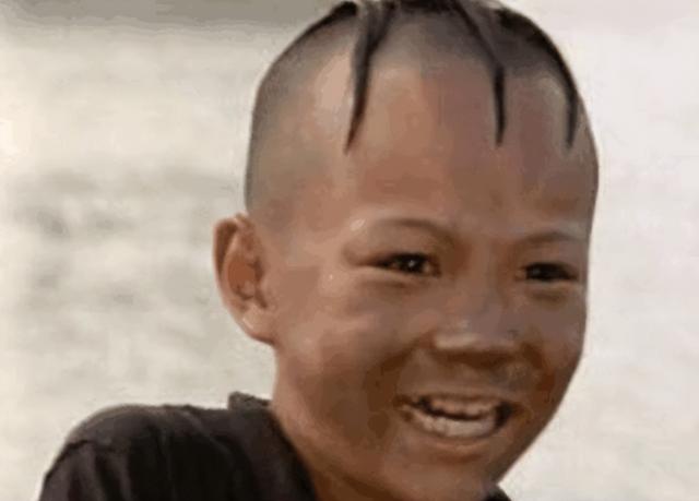 “三毛”孟智超的坎坷星途：14岁秃顶，植发 300 针，复出后被锐评