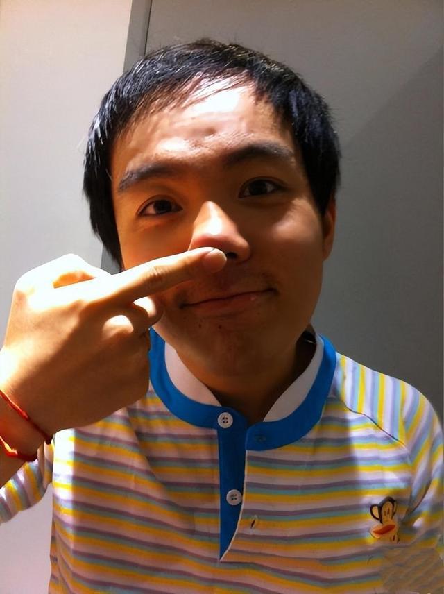 “三毛”孟智超的坎坷星途：14岁秃顶，植发 300 针，复出后被锐评