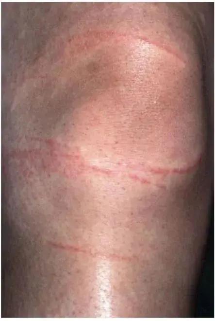 上百人被蜇伤！海边不起眼的“小透明”，杀伤力竟然这么大！紧急提醒