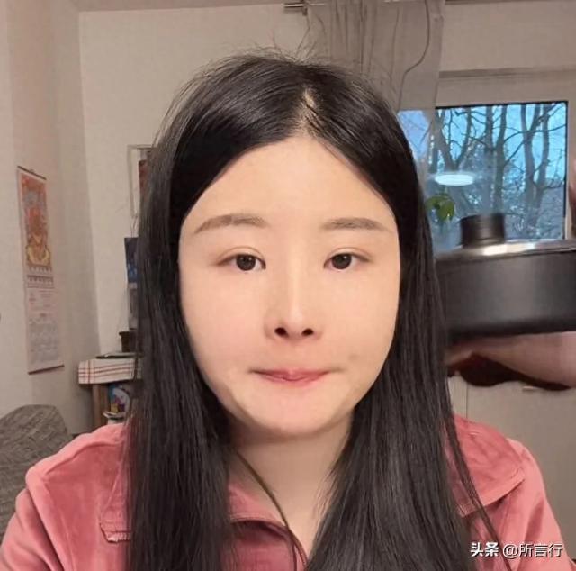 中德苏西:苏西终于手术了,小雪一番话让人心疼,网友直言:真棒