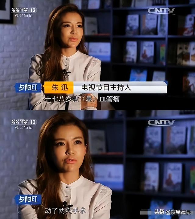 坚强的朱迅：17岁异国患癌，37岁失去父亲，母亲是她一生的痛