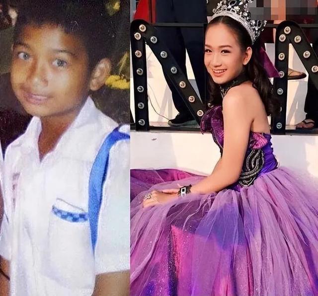 揭秘变性手术全过程：一个男人想变成女人，到底有多难？