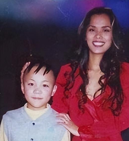 “三毛”孟智超的坎坷星途：14岁秃顶，植发 300 针，复出后被锐评