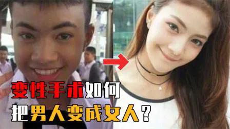 揭秘变性手术全过程：一个男人想变成女人，到底有多难？