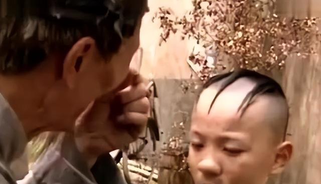 “三毛”孟智超的坎坷星途：14岁秃顶，植发 300 针，复出后被锐评