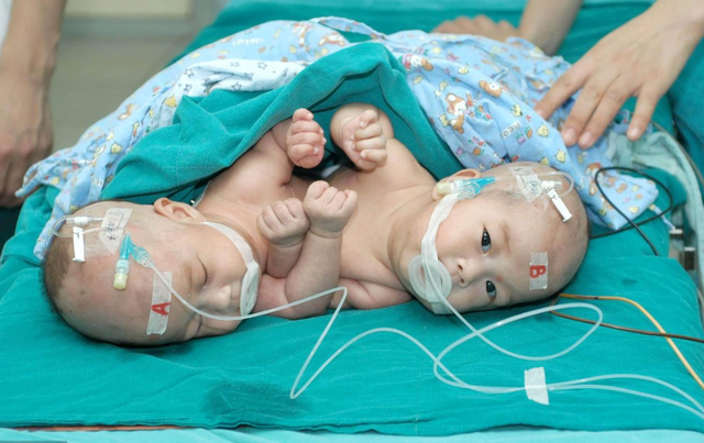 怀上双胞胎全家欣喜若狂，生产时看到两个男孩，医生摇头：活不长