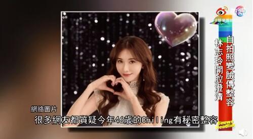 46岁林志玲近照曝光，苹果肌肿胀，脸部僵似充气，撞脸王心凌