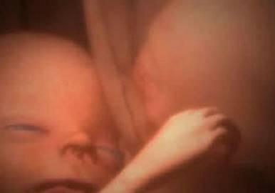 子宫里：双胞胎、三胞胎和四胞胎究竟什么样？八图带你一次看清楚