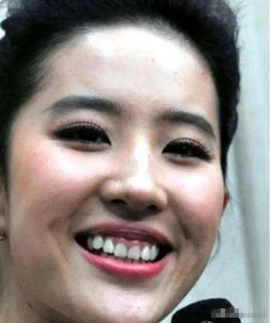 没滤镜真可怕，刘亦菲牙凸嘴大，汤唯皱纹堆积，吕燕满脸雀斑