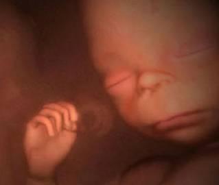 子宫里：双胞胎、三胞胎和四胞胎究竟什么样？八图带你一次看清楚