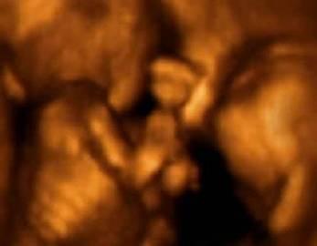 子宫里：双胞胎、三胞胎和四胞胎究竟什么样？八图带你一次看清楚