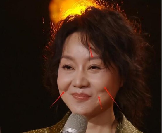 没滤镜真可怕，刘亦菲牙凸嘴大，汤唯皱纹堆积，吕燕满脸雀斑