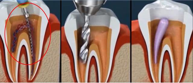 万万没想到！滑进喉咙消失了？男子吓懵：医生没敢告诉我……