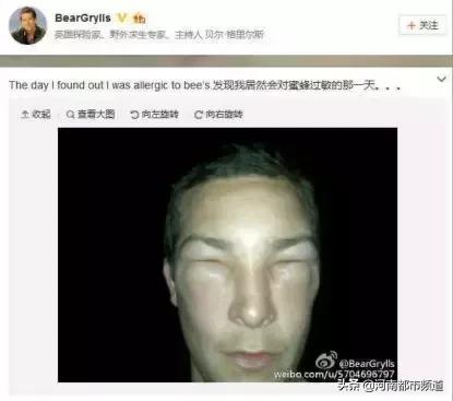 知名主持人贝尔被小蜜蜂蛰了一下！然后事情发展开始跑偏了哈哈哈
