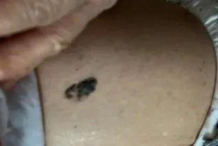 全国网友都在看自己的脚底板！医生：长了这个要人命