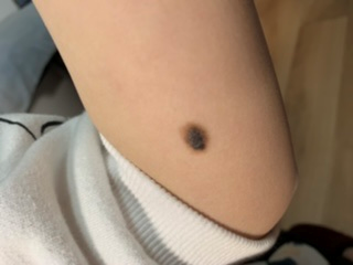 全国网友都在看自己的脚底板！医生：长了这个要人命