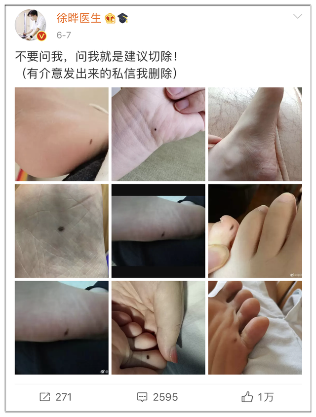 全国网友都在看自己的脚底板！医生：长了这个要人命