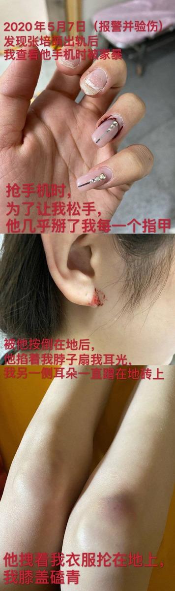 北京卫视女主播遭家暴 养个男孩不容易 养个女孩更难