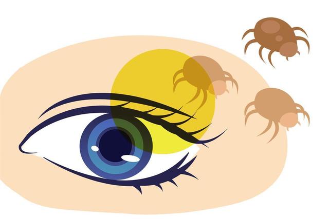 女主播眼睛无故干痒,竟因螨虫爬满睫毛