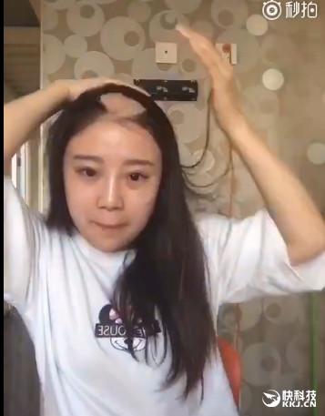 美女电钻啃玉米变秃顶去看医生:真悲剧了