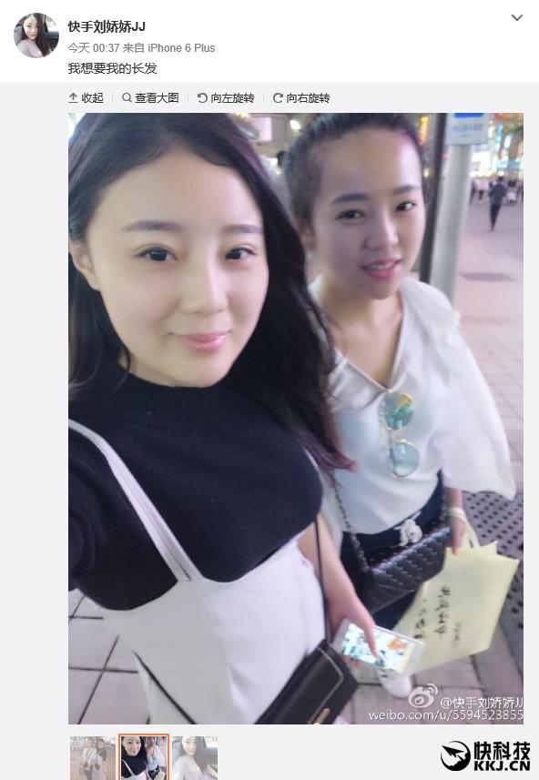 美女电钻啃玉米变秃顶去看医生:真悲剧了