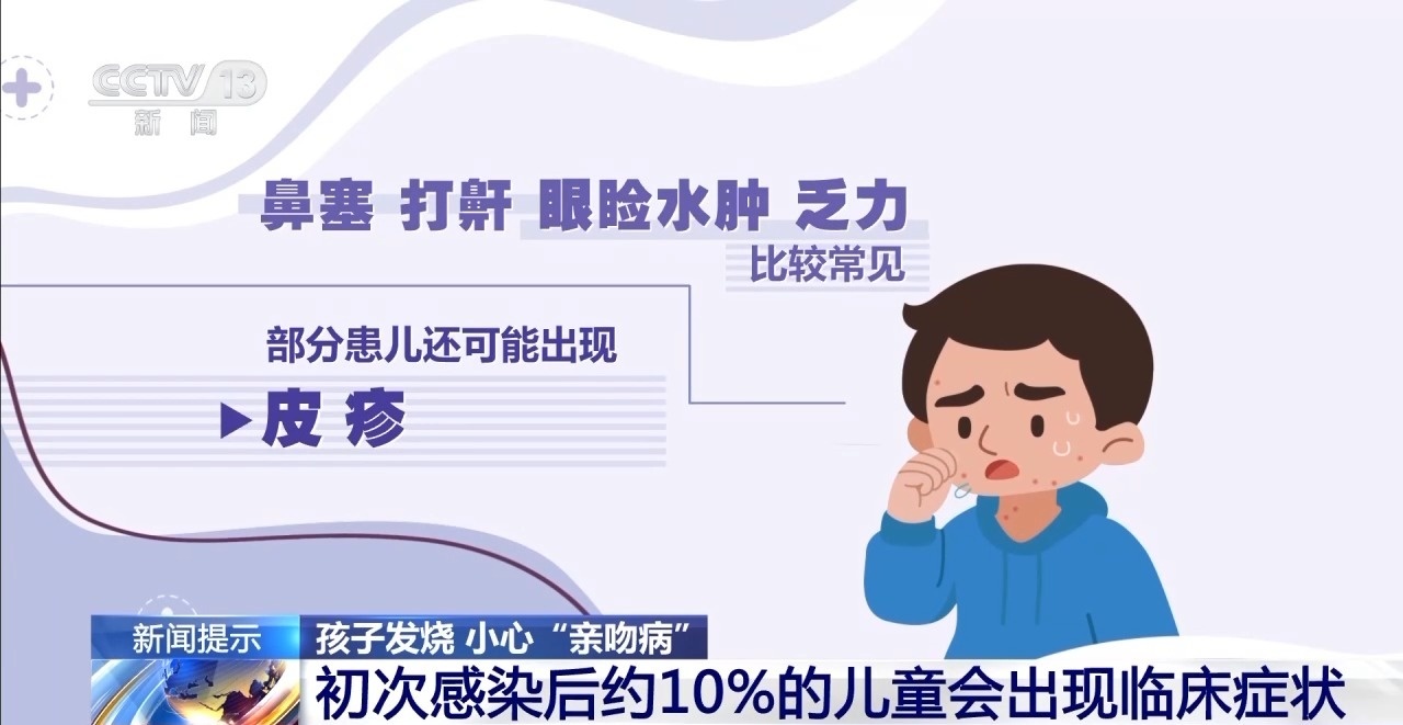 孩子不能又亲又抱 当心“亲吻病”→