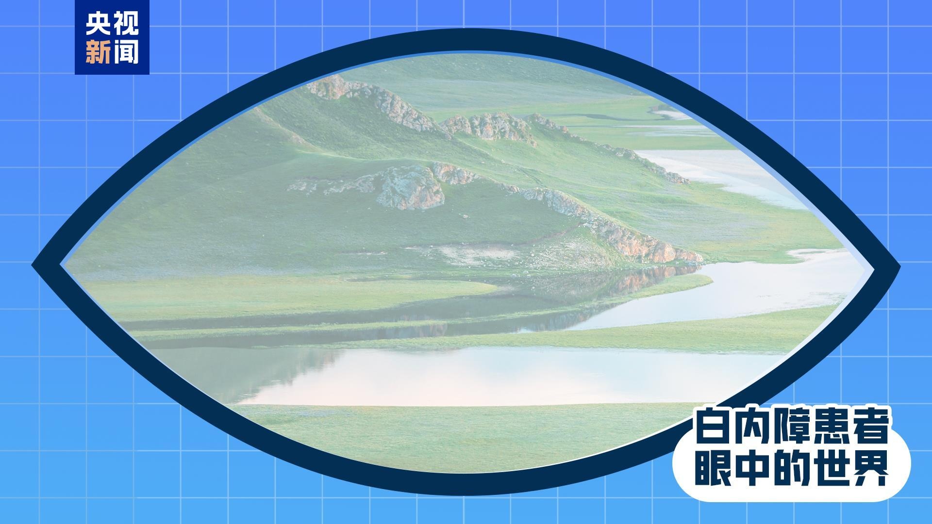 全国爱眼日丨出现这些症状 是眼睛在报警！