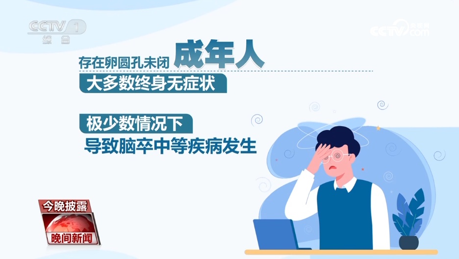 年轻不是“护身符”!警惕脑卒中,牢记“120口诀”