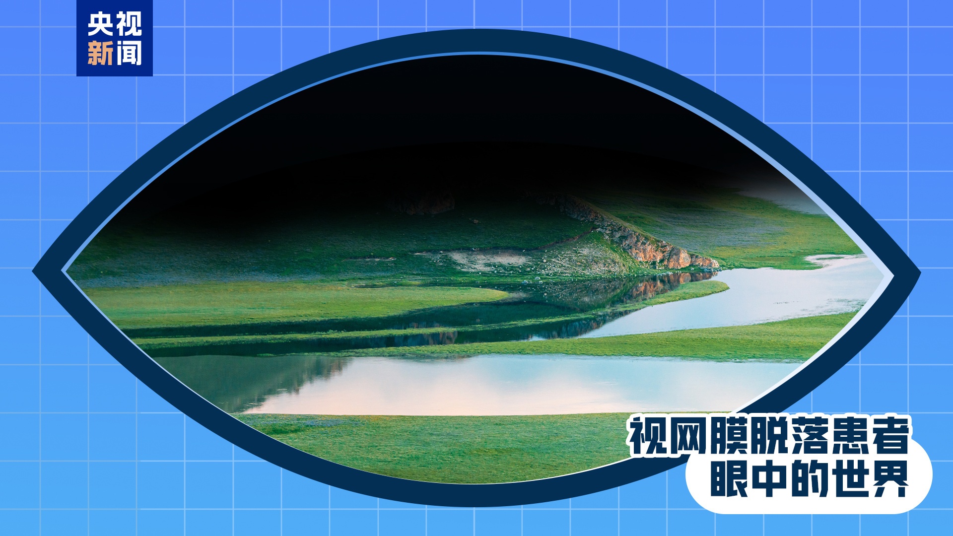 全国爱眼日丨出现这些症状 是眼睛在报警！