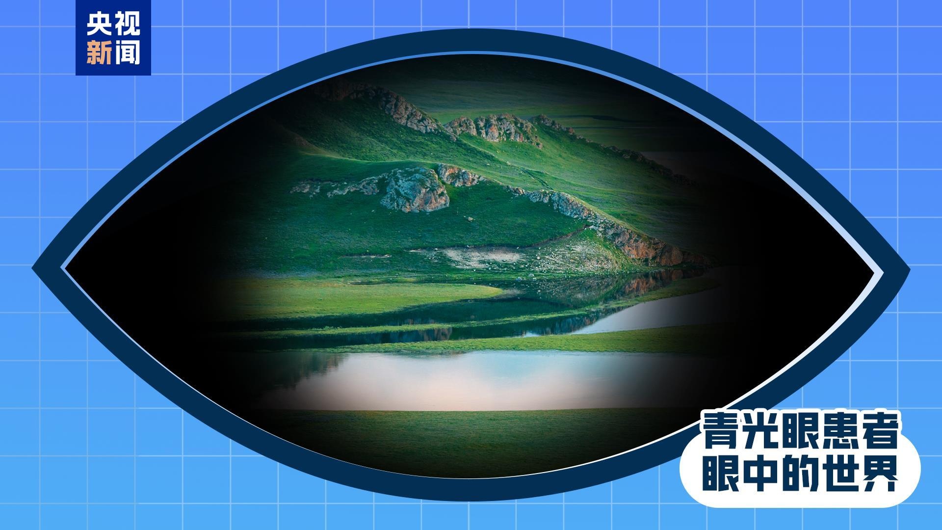 全国爱眼日丨出现这些症状 是眼睛在报警！